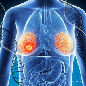 PRS for Breast Cancer (BC-PRS)
