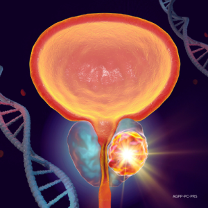 PRS for Prostate Cancer (PC-PRS)